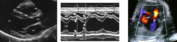 <p>Tipo de eco cardiacas</p>