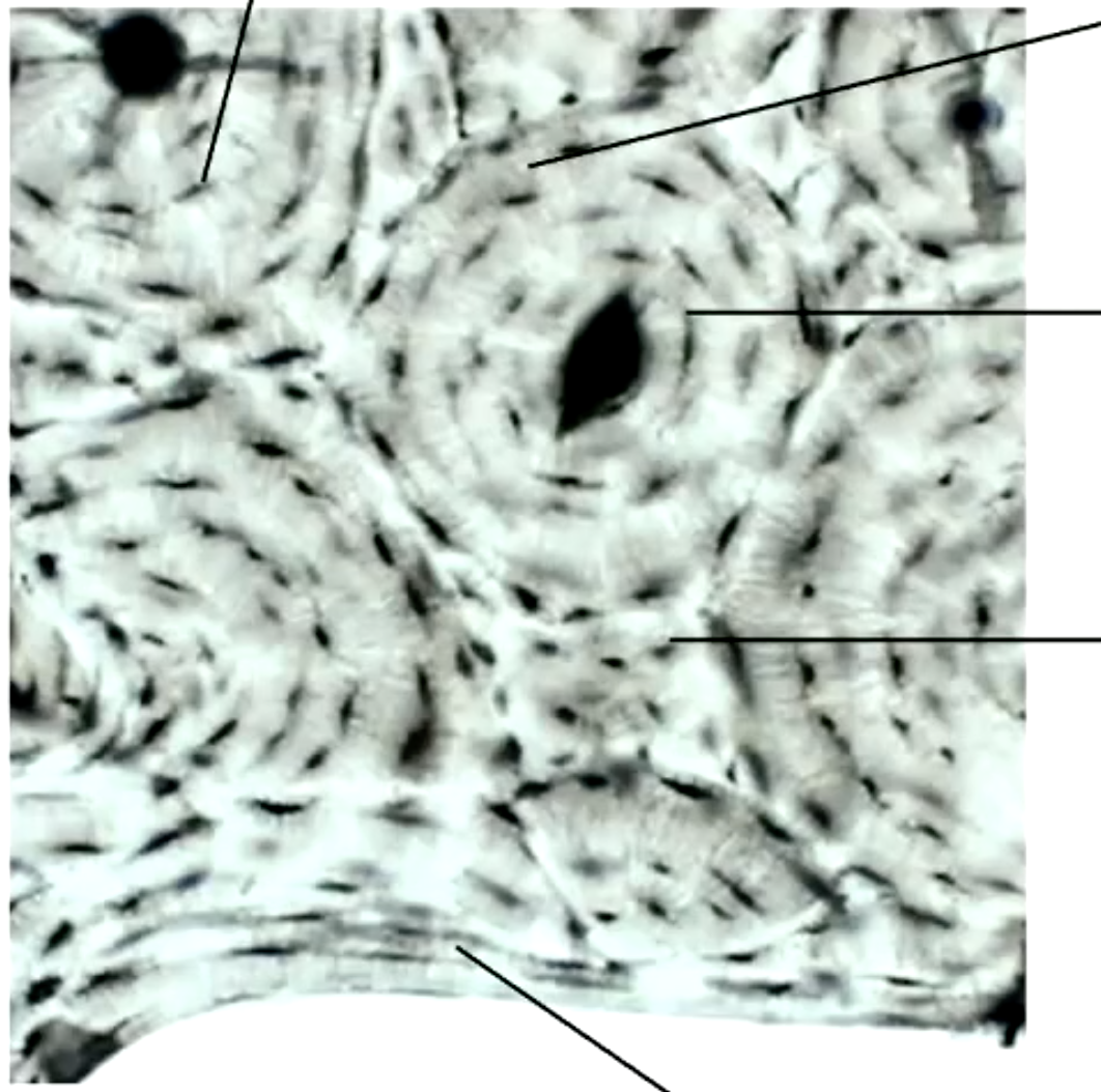 <p>label the parts of the ground section of compact bone</p>