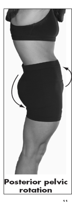 <p>posterior movement of upper pelvis, iliac crest tilts backwards in a sagittal plane; posterior tilt; upward rotation</p>
