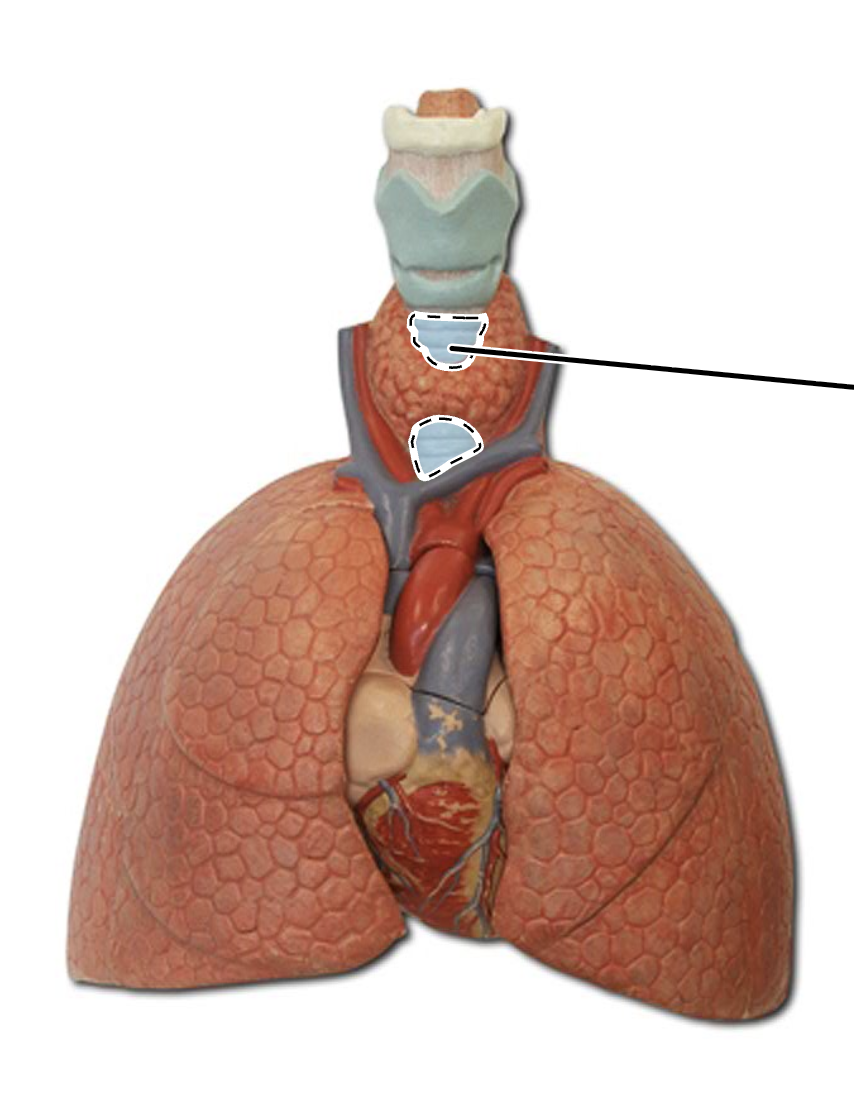 <p>What is this?</p>