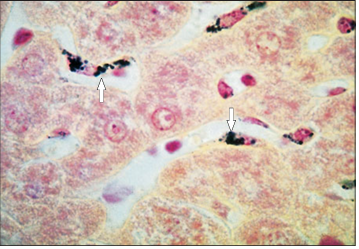 <p>Identify the structure:</p><p>Specie:</p><p>Stain used:</p>