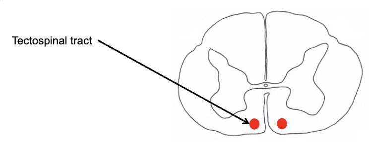 <p><strong>indirect motor pathways</strong></p><ul><li><p>tectospinal tract</p><ul><li><p>mediates reflexive movement of head and neck in response to _____ stimuli (predominantly vision and hearing)</p></li><li><p>originates from the _______ (SC, midbrain) and descends through cervical levels of the spinal cord&nbsp;</p></li></ul></li></ul><p></p>