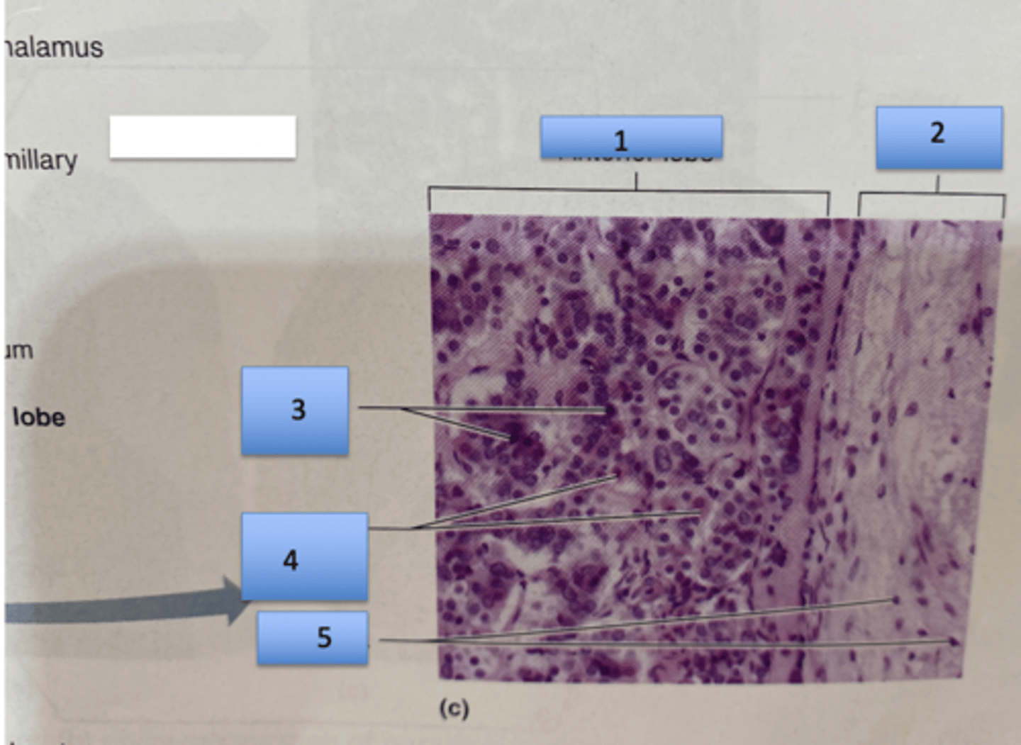 <p>1. Anterior Lobe</p><p>2. Posterior lobe</p><p>3. Basophil cells (remember purple ring)</p><p>4. Acidophil cells (remember pink ring)</p><p>5. Neuroglia (remember no ring)</p>