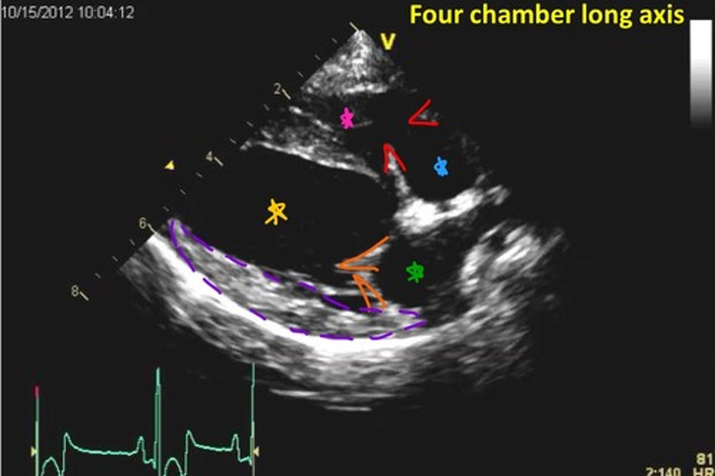 <p>ID parts of heart</p>