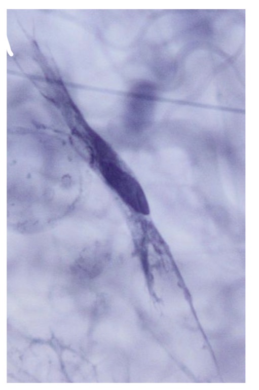 <p>• Neaktyvi ląstelė (sintezės aspektu)</p><p>• Branduolys heterochromatiškas, verpstės formos</p><p>• Gali virsti aktyvia (ypač įvykus audinio pažeidimui)</p>