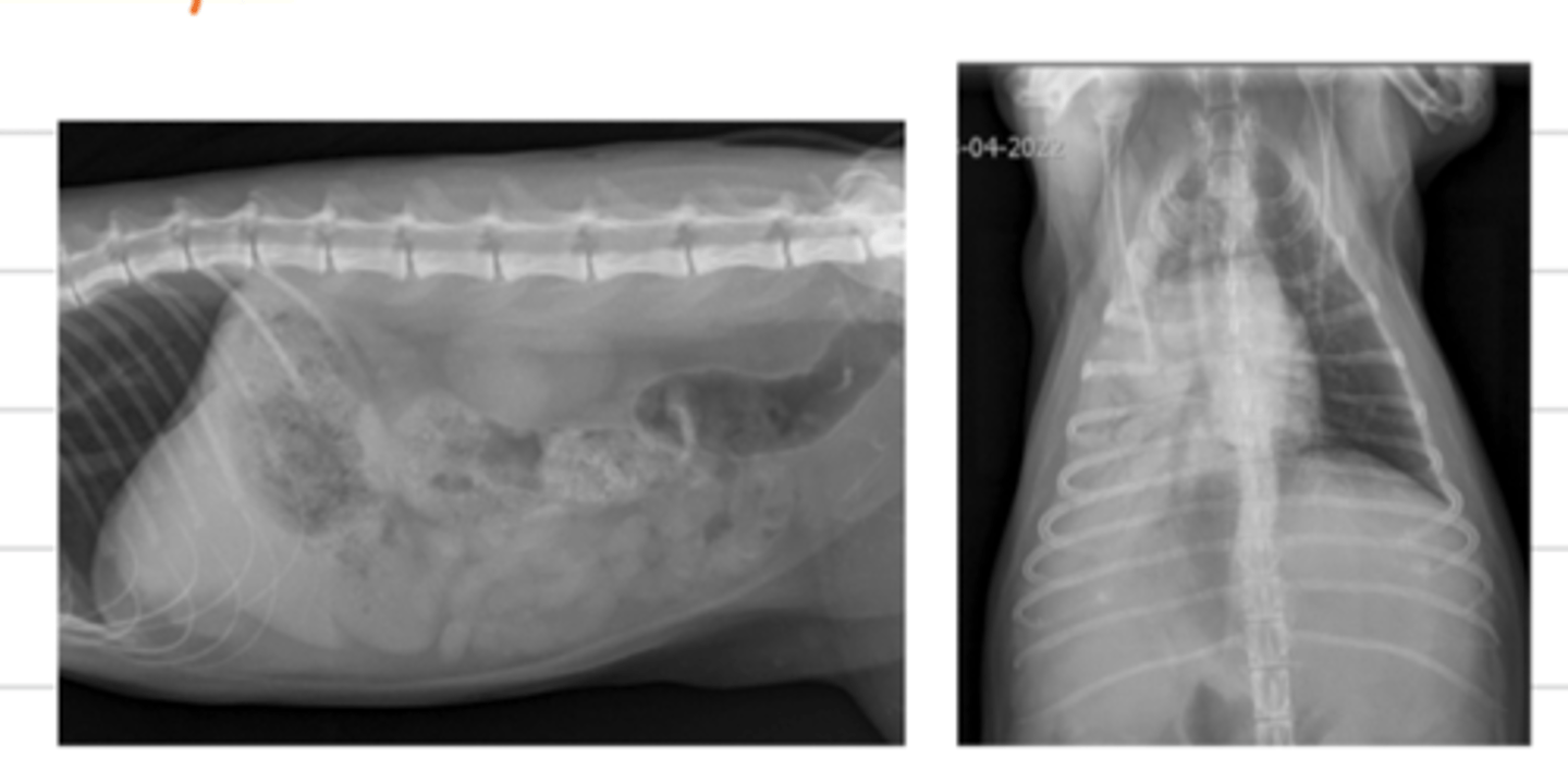 <p>when 2 structures of the same opacity are in contact, so we cannot distinguish their margin in the image.</p>