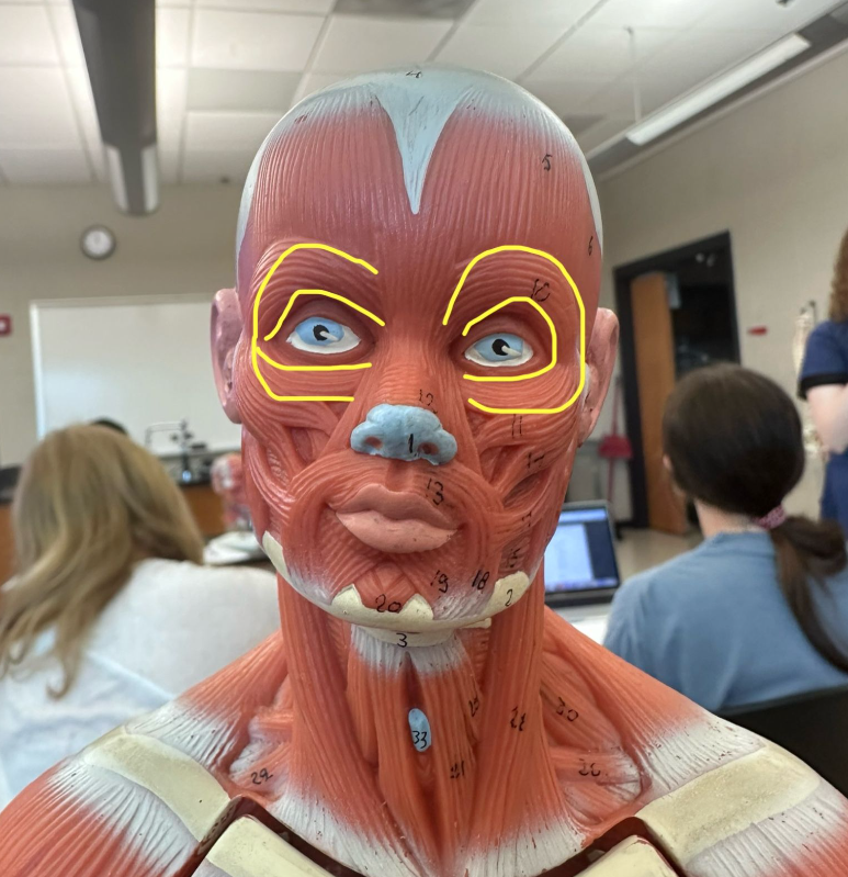 <p>What muscle is the yellow line indicating? What action does this muscle perform? </p>