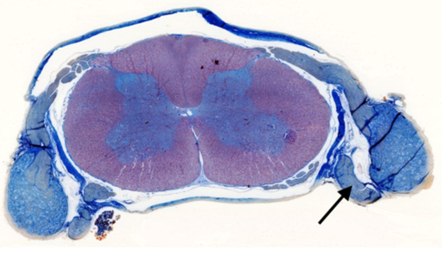 <p>Identify the part of the spinal cord</p>