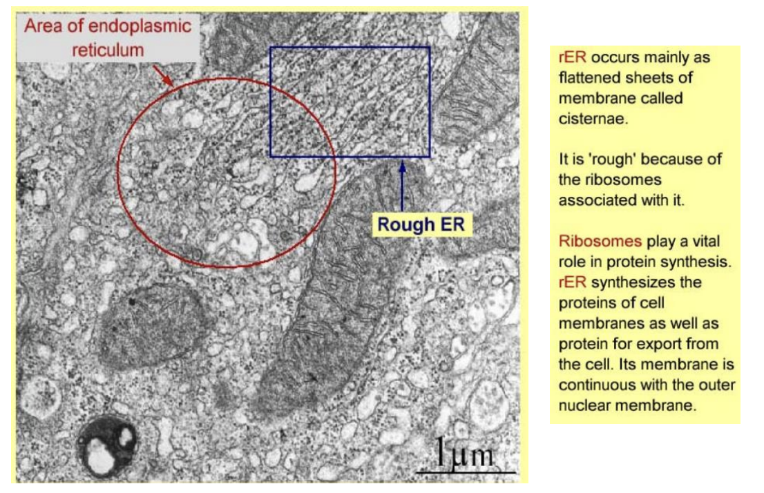 <ul><li><p>flattened sheets→ cisternae</p></li><li><p>rough→ ribosomes</p></li><li><p>protein synthesis and export</p></li></ul><p></p>