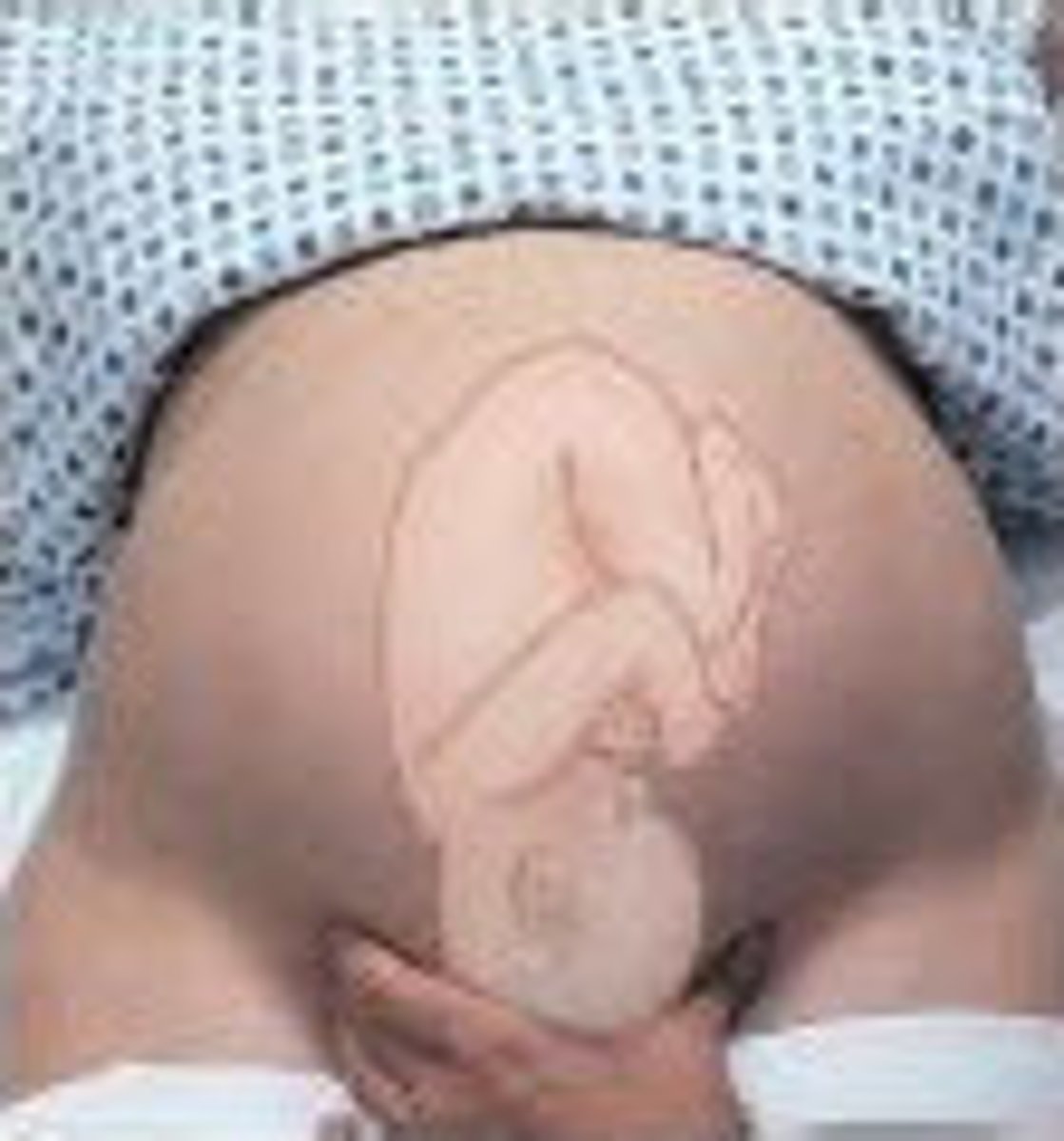 <p>suprapubic palpation by using the thumb and fingers of the dominant hand</p><p>examiner ascertains the fetus' presentation and examines its station</p><p>if presenting part is not engaged, a movable body can be felt</p><p>Allows for assessment of fetal weight and volume of amniotic fluid</p>