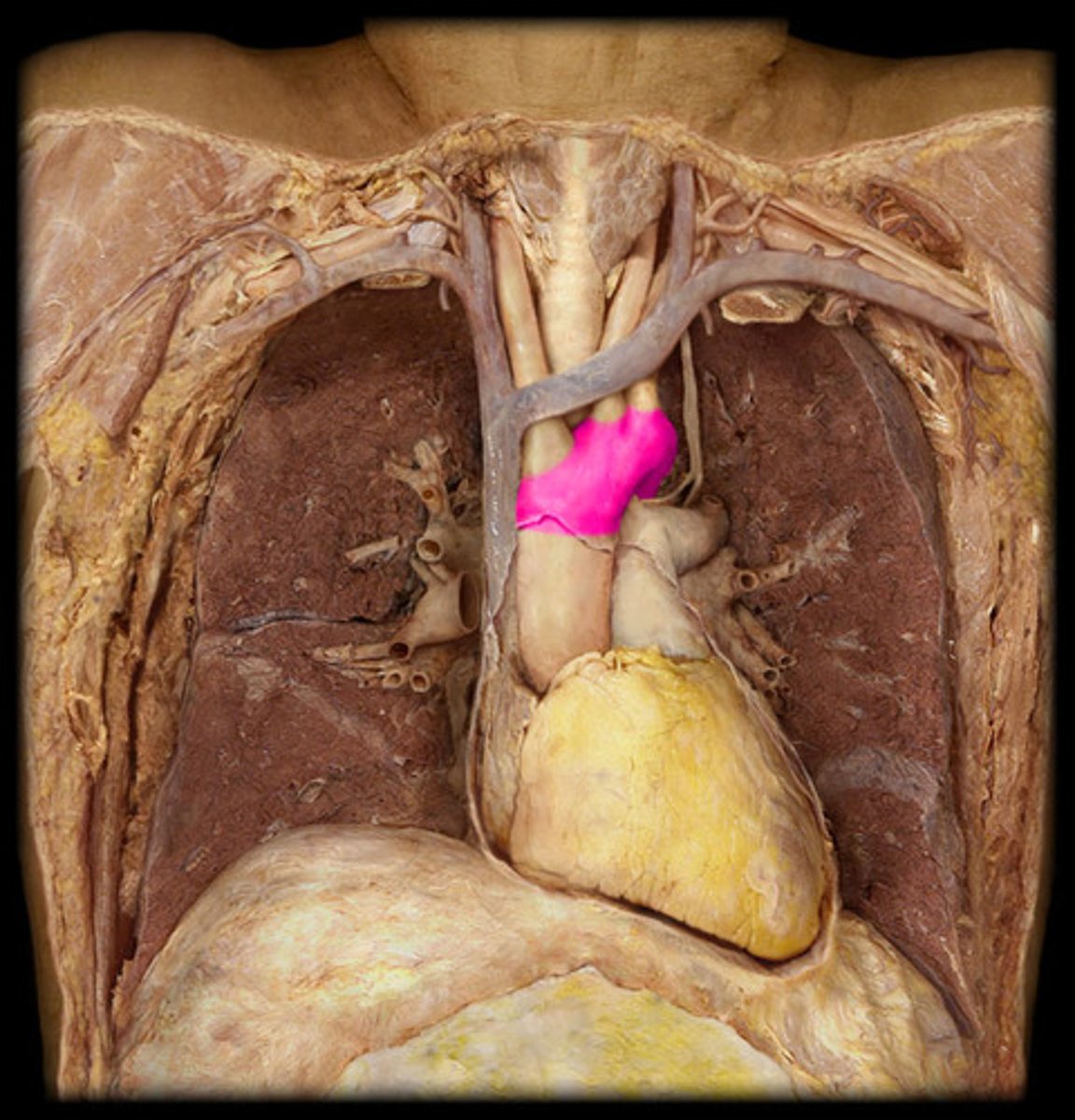 <p>Name the Artery</p>