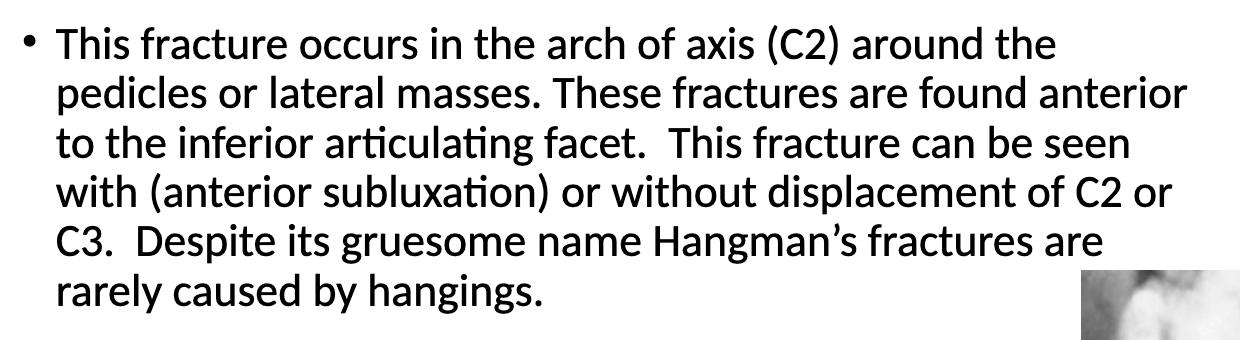 <p>Fracture in the arch of C2 around the pedicles or lateral masses</p><p>(from hyperextension <em>imagine neck greatly extended from hanging</em>)</p>