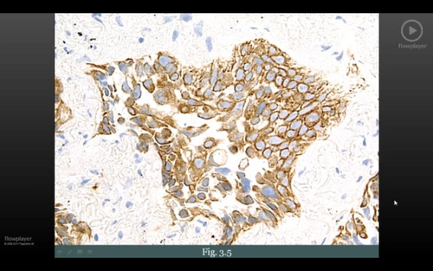 <p>what stain is this</p>
