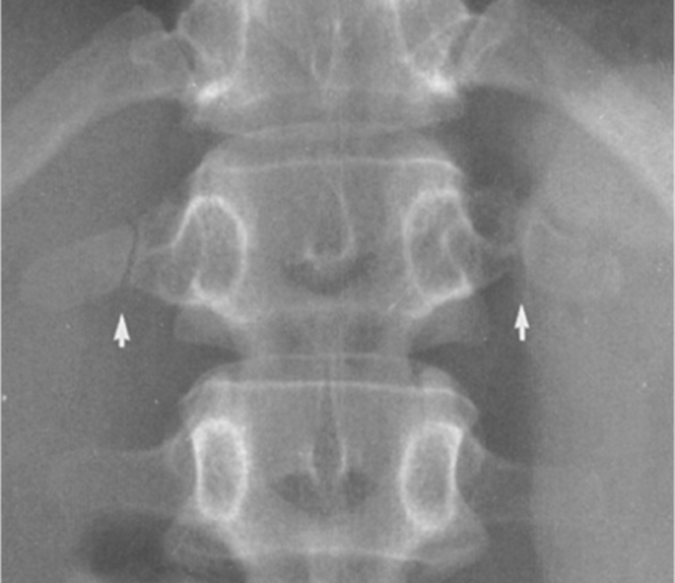 <p>Describe findings</p>