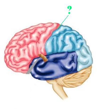 <p><span><span>Identify the indicated groove of the brain</span></span></p>