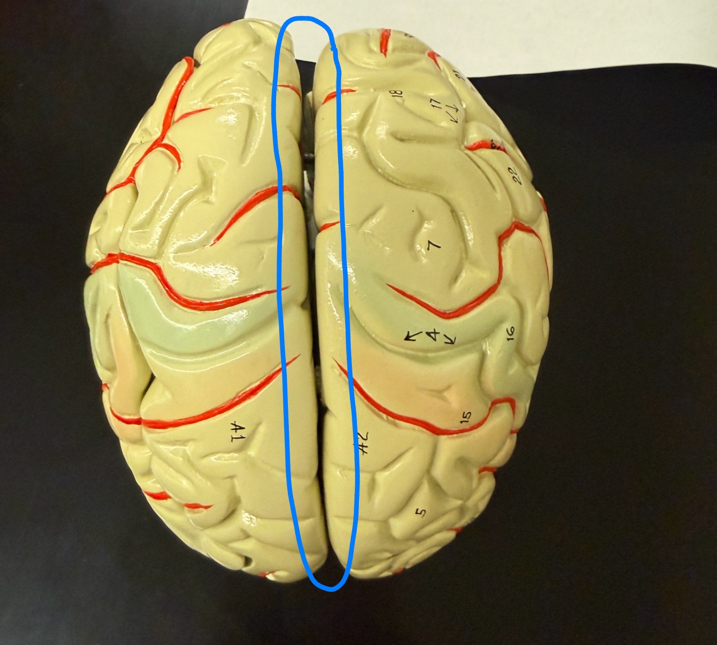 <p>What is outlined in blue on the brain model?</p>