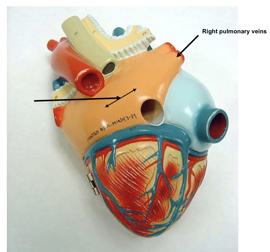<p>Right pulmonary veins </p>
