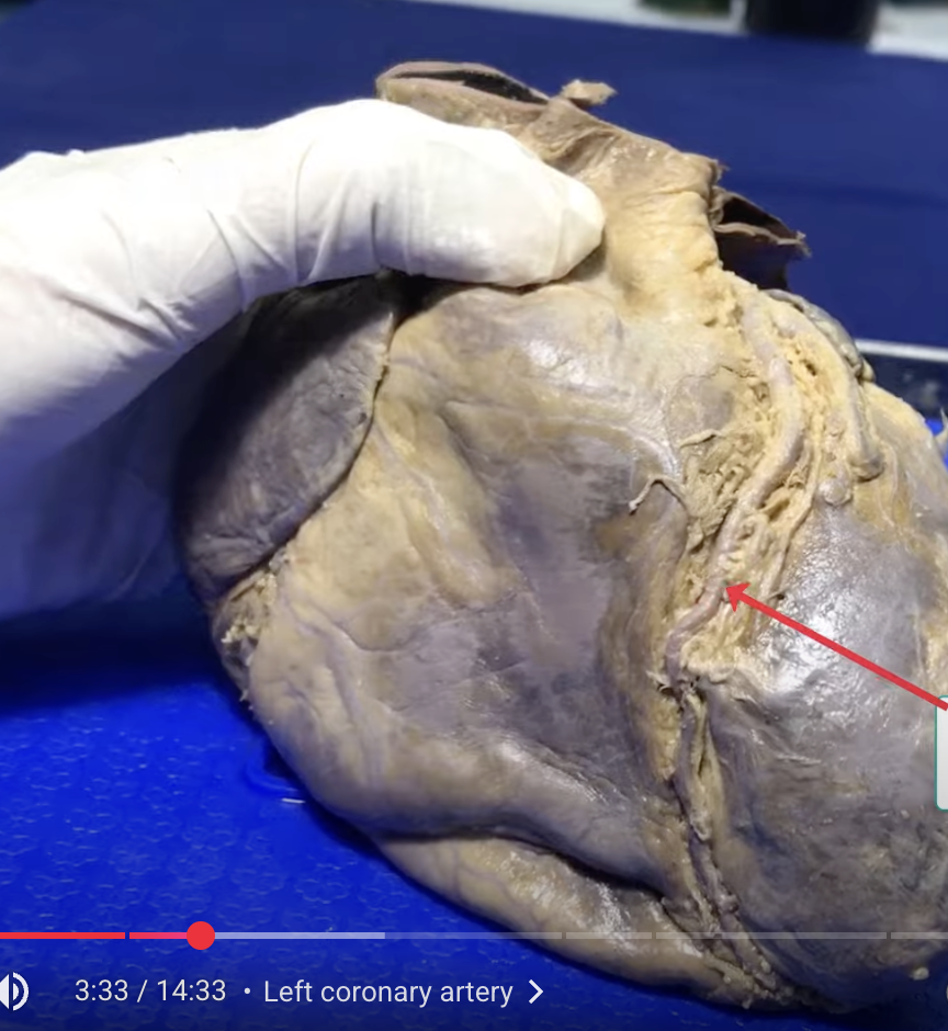 <p>name this artery that is near the left atrium and ventricle</p>