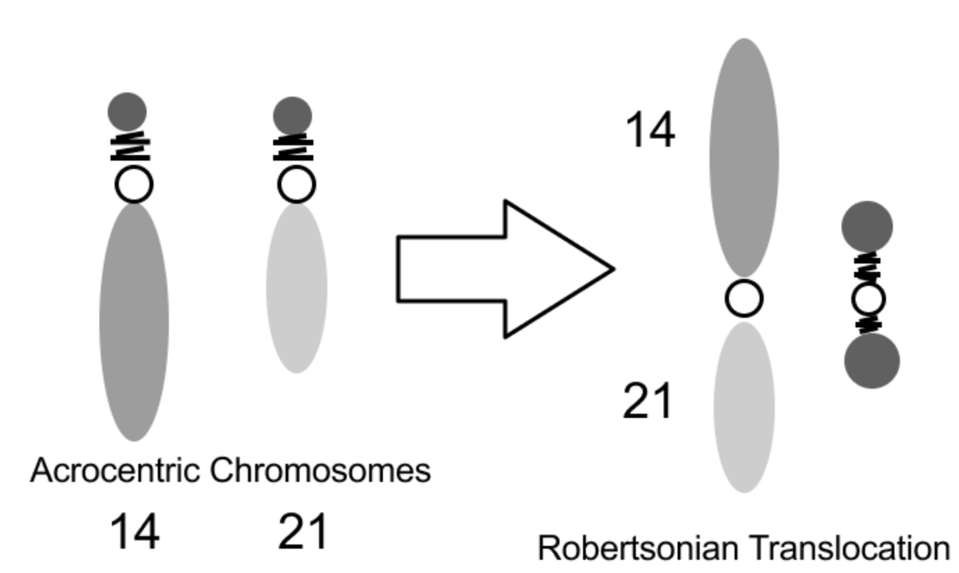 <p>A Robertsonian translocation involves the fusion of two acrocentric chromosomes, leading to potential genetic imbalances.</p>