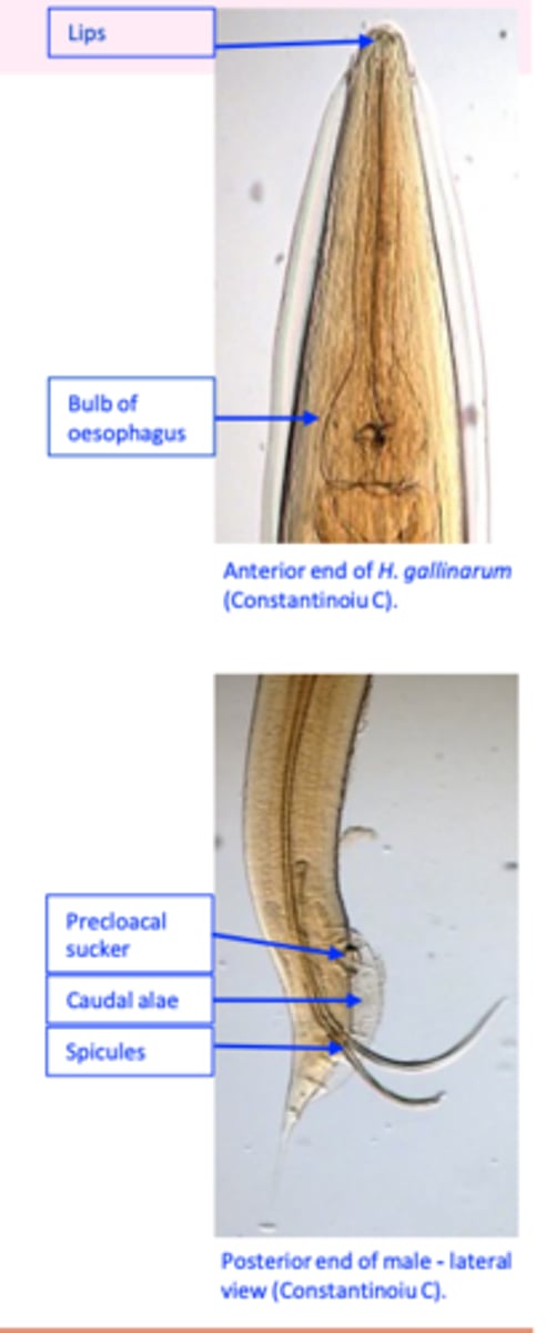 <p>Anterior end</p><p>Mouth provided with three lips;</p><p>Oesophagus ends in a well-developed bulb;</p><p>Posterior end</p><p>• Male</p><p>- precloacal sucker</p><p>• Female</p><p>- Long, narrow and pointed.</p>