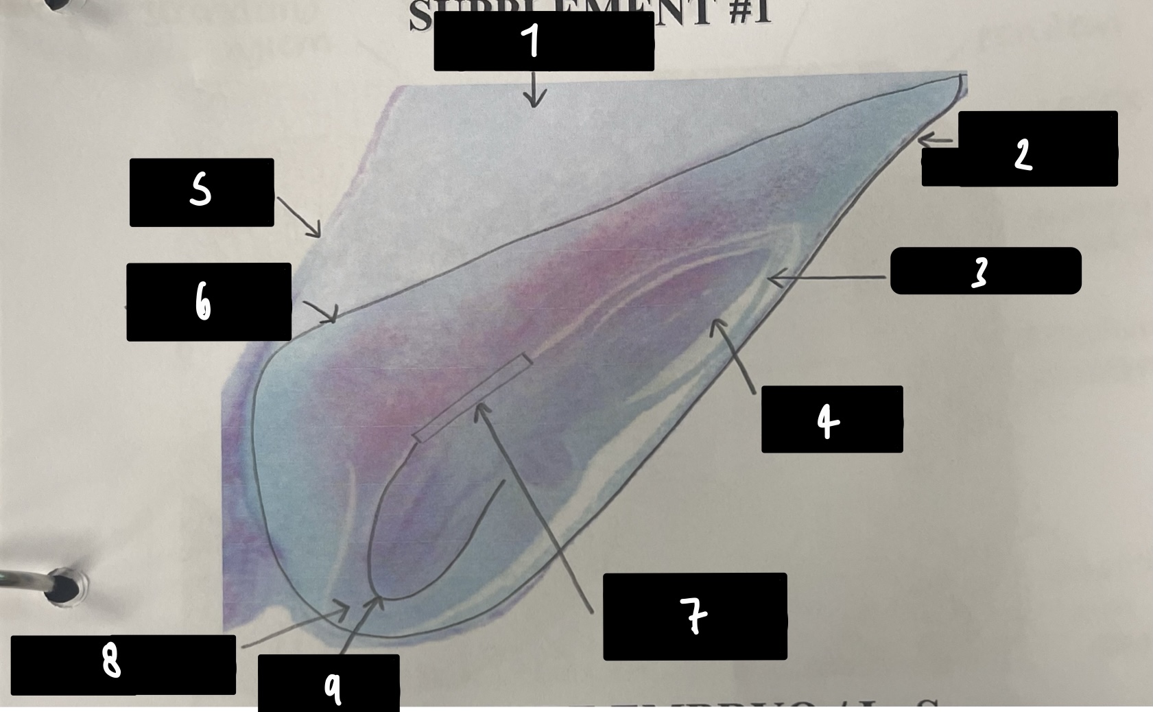 <p>name the structure in label 3</p>