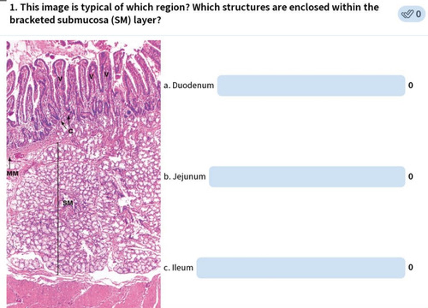 <p>small intestine-duodenum</p><p>Brunner's glands</p>
