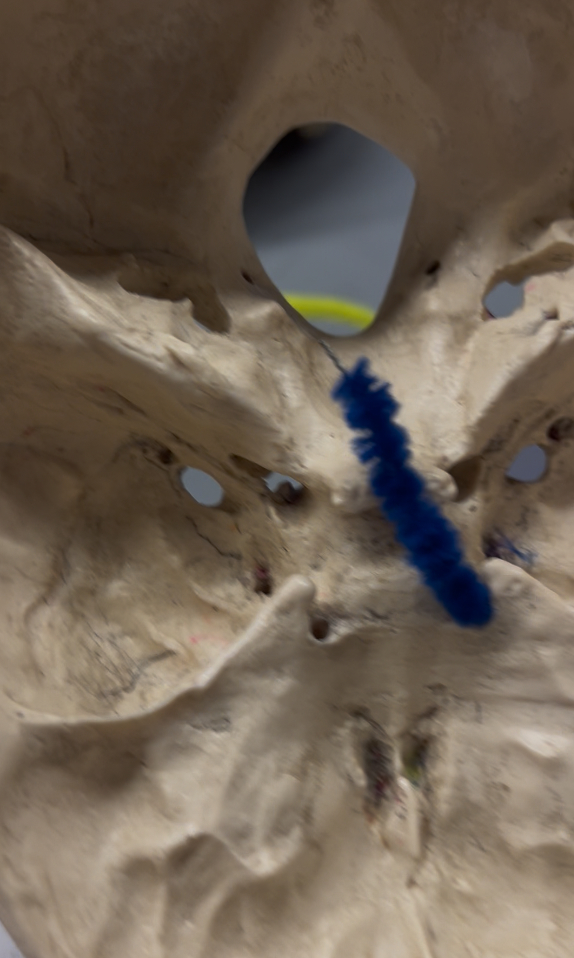 <p>What foramina is labeled by the blue pipe? What bones are the located? Also, which if any cranial nerves pass through there?</p>
