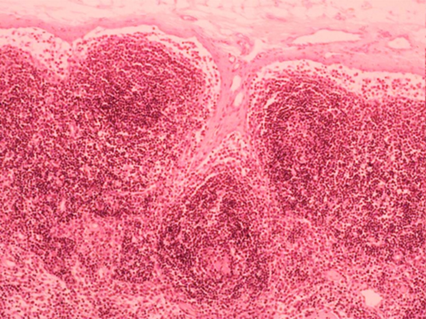 <p>ID Structure</p><p>lymph node capsule</p>