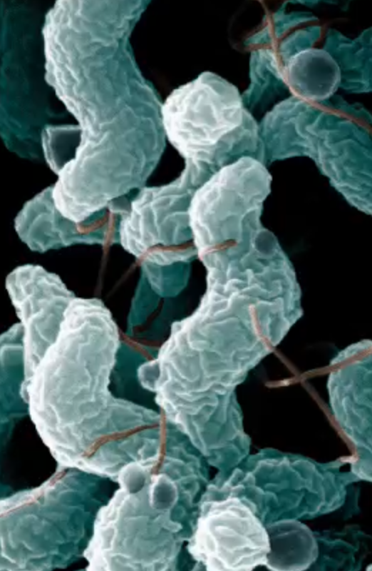 <p><span style="color: rgb(16, 5, 146);"><strong>Campylobacter Jejuni </strong></span></p>