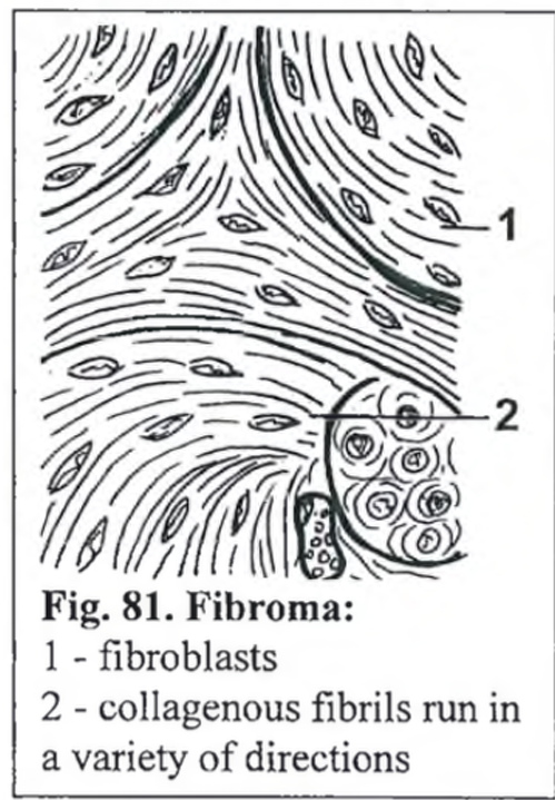 <p><strong>Fibroma mole</strong> - tumor</p><ul><li><p>picture 1: aimlessly running of fibrous fibers, in many directions - felt structure. </p></li><li><p>pic. 2: miscellaneous differentiation of cells - fibroblast and fibrocytes - small amount of collagen</p></li><li><p>pic 3: cell infiltrations - heterophils, lymphocytes and macrophages and focal edema</p></li></ul><p></p>