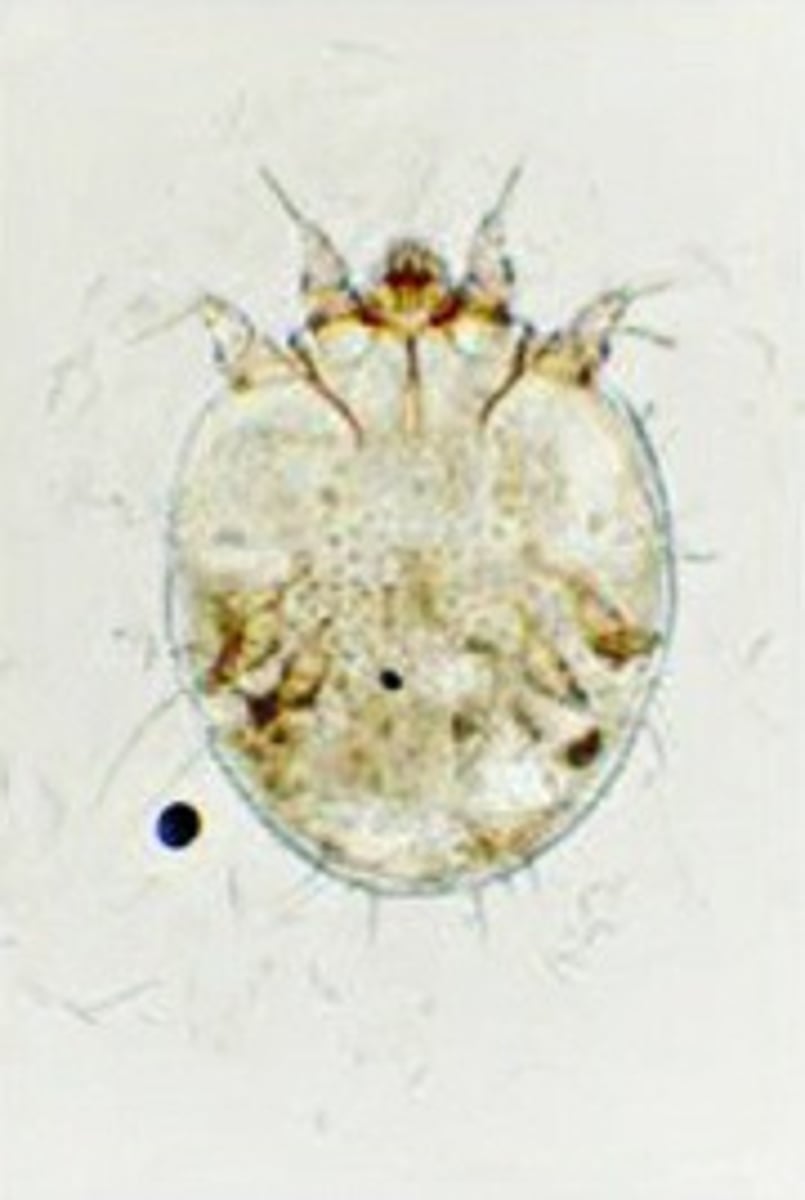 <p><span>This was found on a dog with intense pruritus.&nbsp;&nbsp;What is it?&nbsp; Is it contagious to humans?</span></p>