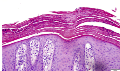 <p>Corneocytes (dead cells) which lack nuclei</p><p></p>