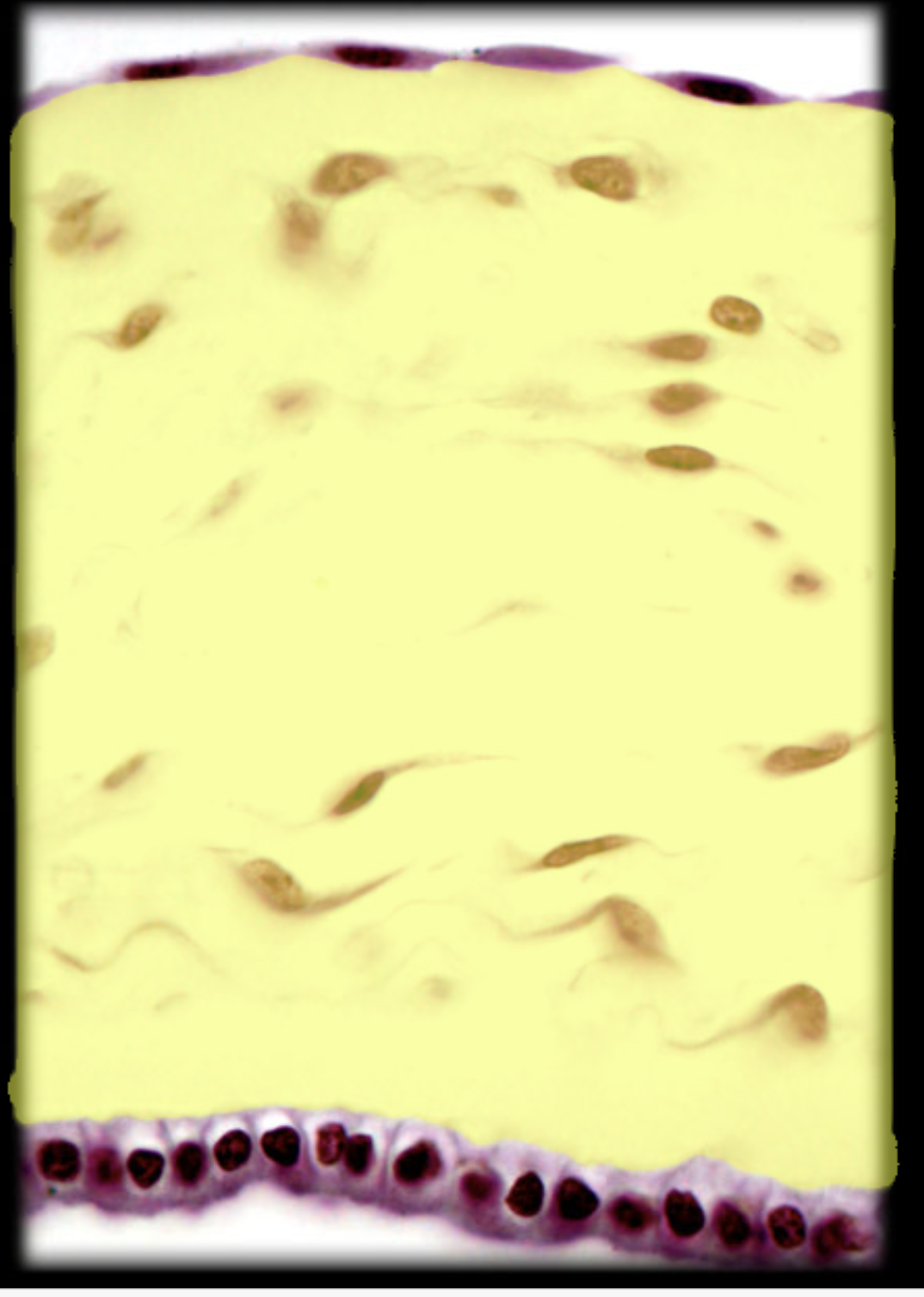 <p>Embryonic loose Connective Tissue</p>
