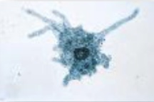 <p>What is this (1/4 classification of protozoans)</p>