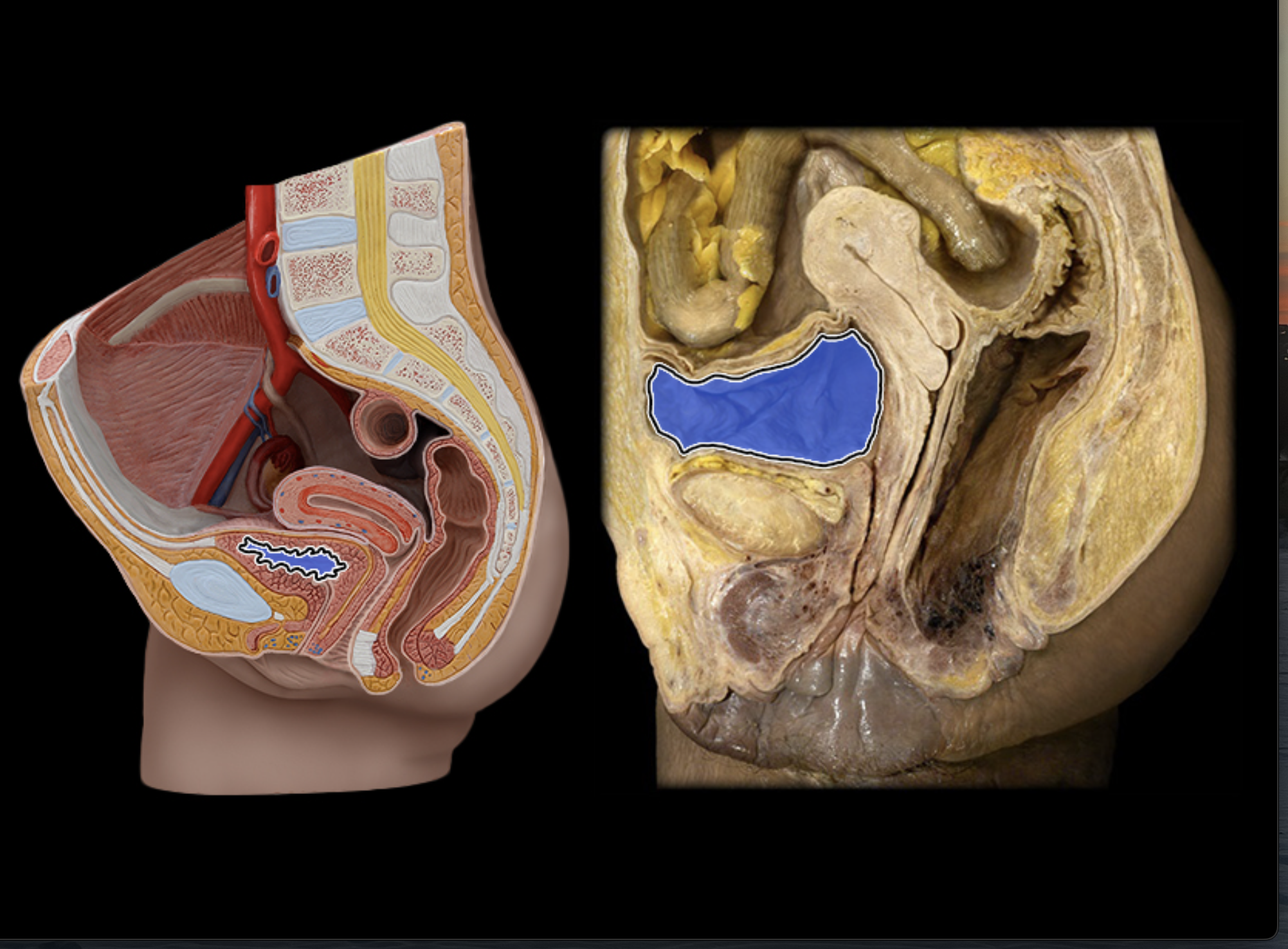 <p>Fold/ridges in urinary bladder</p>