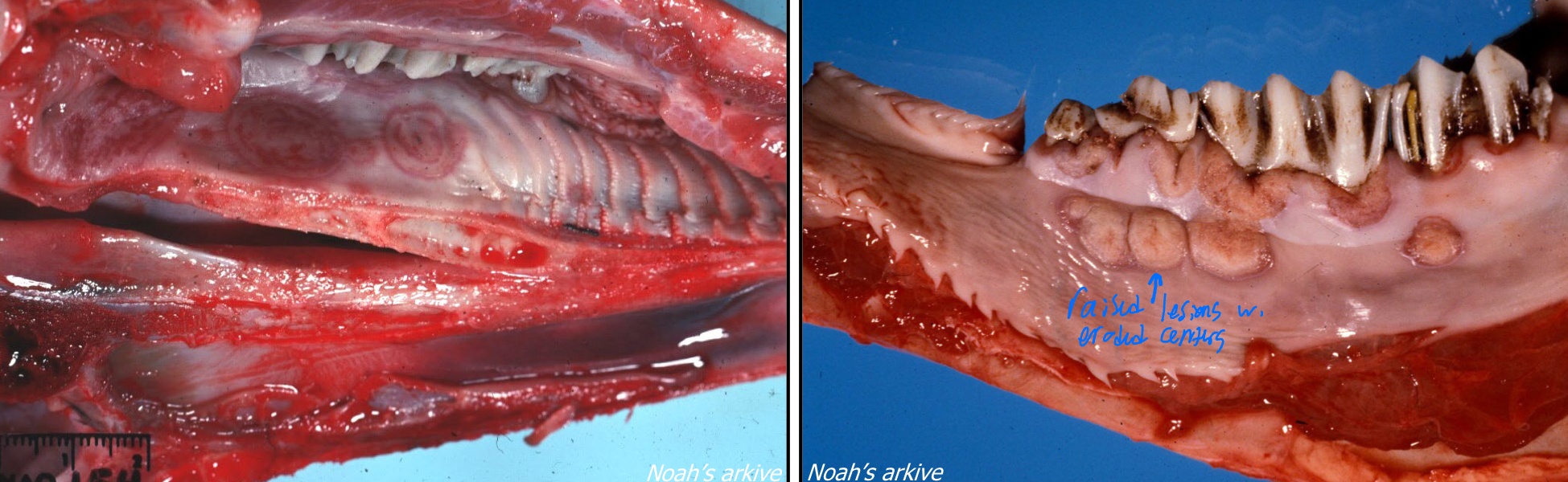 <p>What disease is this most likely?</p>