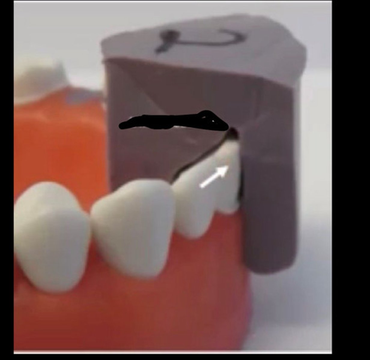 <p>A common error is</p>