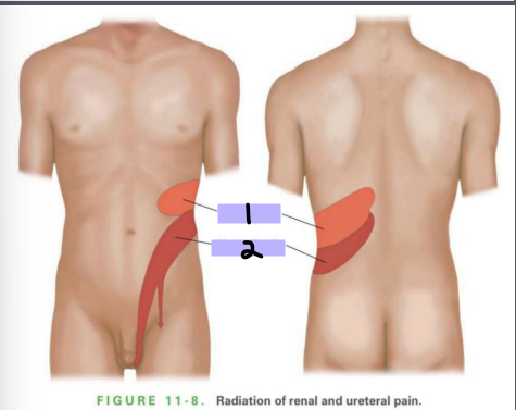 <p>Pain in #1 could be indicative of a ________ issue, while pain in #2 could be indicative of _________ pain</p>