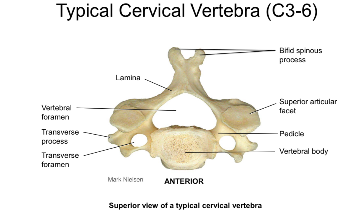 <p>Transverse foramen</p>