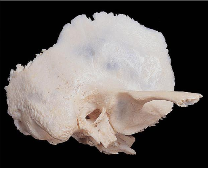 <p>Identify this cranial bone.</p><p></p><p>A. parietal bone</p><p>B. sphenoid bone</p><p>C. ethmoid bone</p><p>D. temporal bone</p>