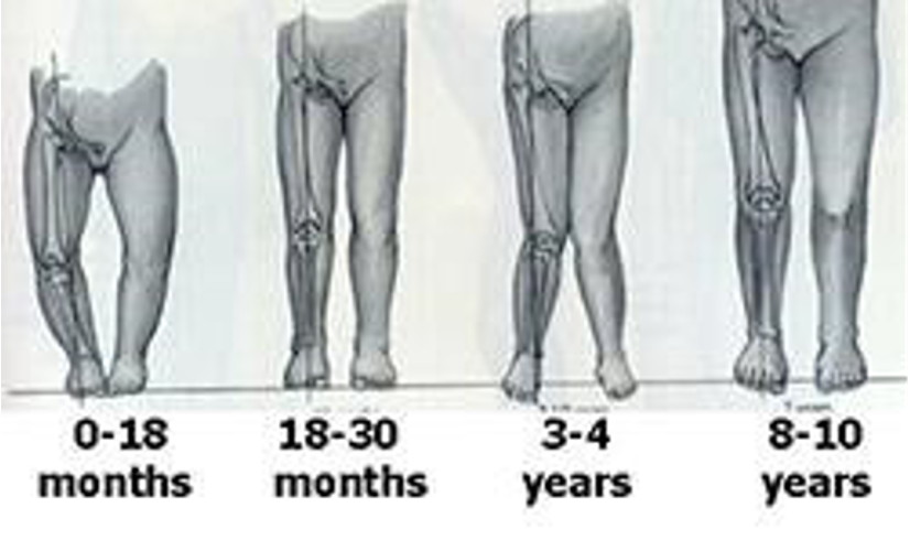 <ul><li><p>0-18 months = varus </p></li><li><p>18-30 months = straight </p></li><li><p>3-4 years = valgus </p></li><li><p>8-10 years = straight </p></li></ul><p></p>