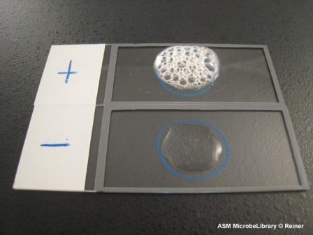 <ul><li><p>An enzyme that some bacteria produce to <u>neutralize the bactericidal effects of hydrogen peroxide</u></p></li><li><p>Test: Catalase test - indicates if the bacteria produces an enzyme that can break down hydrogen peroxide into water and carbon dioxide</p></li></ul><p></p>
