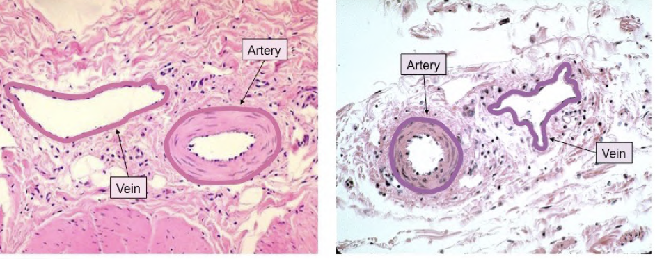 <p>Detailed Diagram of veins and arteries</p>