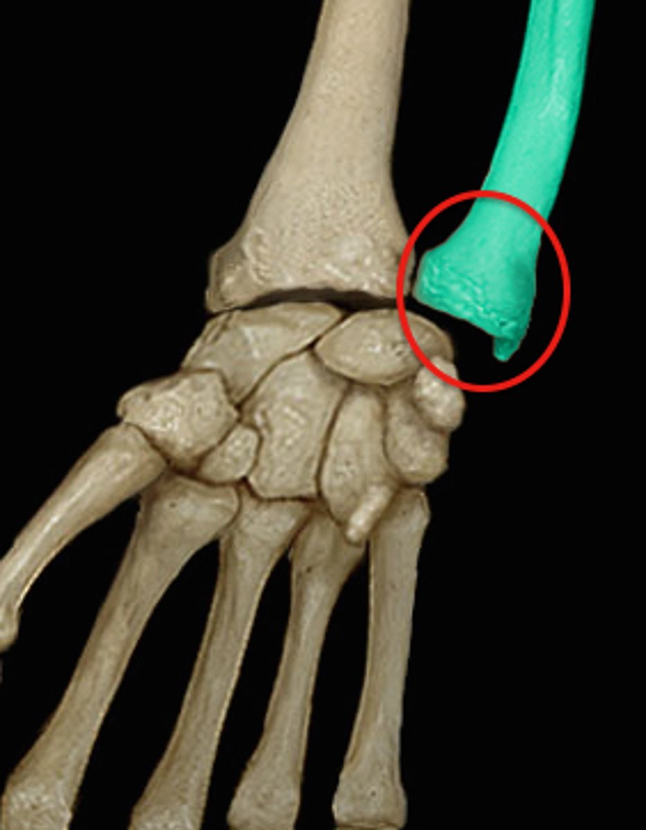 <p>distal end of ulna</p>