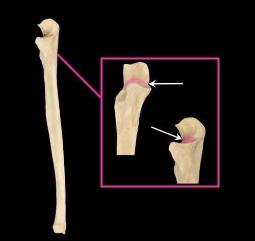 <p>(p.)</p>