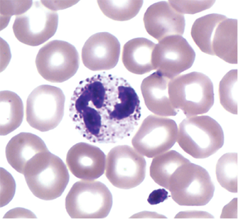 <p>Neutrophil</p>