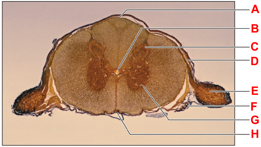 <p>using the spinal cord histology slide, determine label C</p><p></p><p>wordbank: central canal, dorsal horn, dorsal median sulcus, dorsal root, dorsal root ganglion, ventral horn, ventral median fissure, ventral root</p>