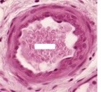 <p>What artery type? What features identify it?</p>