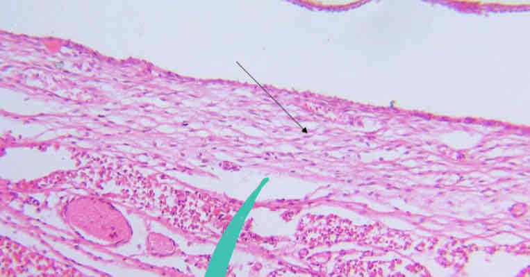 <p>Connective Tissue</p>