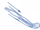 <p>muscle lengthens</p><p>produces tension while lengthening</p><p>bringing weight down</p>